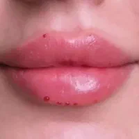 خدمات تخصصی فیلر و بوتاکس در رشت|خدمات آرایشگری و زیبایی|رشت, گلسار|دیوار