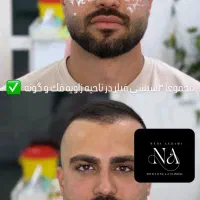 ژل لب و فول فیس ۳۷۰هزار تومان توسط پزشک کلینیک|خدمات آرایشگری و زیبایی|کرج, گوهردشت|دیوار