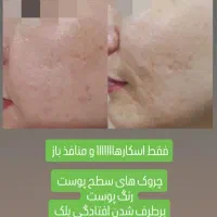 جوانساز|آرایشی، بهداشتی، درمانی|شیراز, ستارخان|دیوار