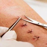 تزریقات و سرم تراپی پرستار در منزل مهاباد|خدمات آرایشگری و زیبایی|مهاباد (آذربایجان غربی), |دیوار