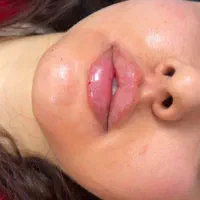 اموزش ژل و بوتاکس و پی ار پی