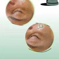 پاکسازی پوست .با بهترین متریال روز دنیا|خدمات آرایشگری و زیبایی|اصفهان, ملک‌شهر|دیوار