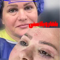 تزریق ژل و بوتاکس|خدمات آرایشگری و زیبایی|ارومیه, |دیوار