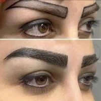 جراحی پلک وغبغب/نخ لیفت وکلاژن/فیلر/چربی/ژل ۴۹۰|خدمات آرایشگری و زیبایی|کرج, گوهردشت|دیوار