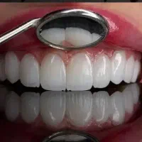 دستیار دندانپزشک خانوم