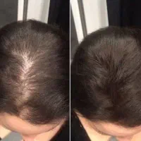 دوباره به پرپشت شدنش فکر کن