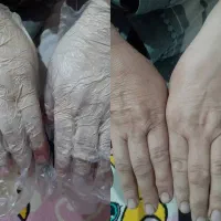 مشاوره رایکان پوست و مو ،درمان لک و ...|آرایشی، بهداشتی، درمانی|رشت, دروازه لاکان|دیوار