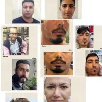کاشت مو کاشت ریش و کاشت ابرو ومزو وپی آر پی