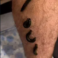 زالو،حجامت،فصد خون،مشاوره طب سنتی عباسیه نجف آباد|خدمات آرایشگری و زیبایی|یزد, |دیوار