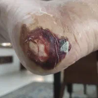 کارشناس و پانسمان تخصصی زخم/خدمات پرستاری در منزل|خدمات آرایشگری و زیبایی|اصفهان, جلفا|دیوار