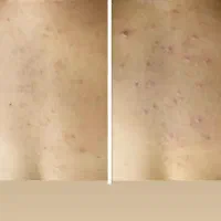 فیشیال بدن|خدمات آرایشگری و زیبایی|شیراز, بعثت|دیوار