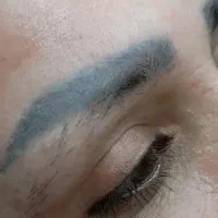 پاک کردن تتو با قیمت استثنایی فقط بانوان