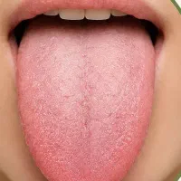 تشخیص بیماری از روی عکس زبان رایگان