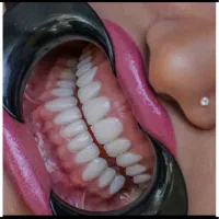 جشنواره کامپوزیت دندان بحران جنگ