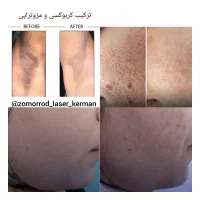 کلینیک پوست،مو،لیزر،لاغری و کربوکسی تراپی|خدمات آرایشگری و زیبایی|کرمان, |دیوار