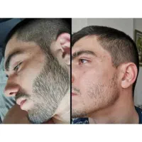 ریشاتو جنگل کن
