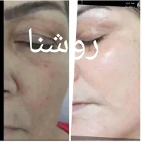 کرم(تخفیف ویژه. ) هرسه عدد کرم به قیمت عمده و عالی