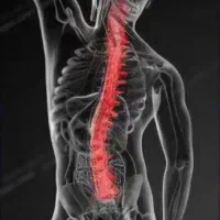 فیزیوتراپی در منزل