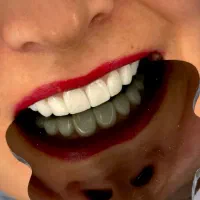 دندانپزشکی/ایمپلنت فوری و بدون درد ۸۷۰۰