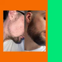 وقتش ریشات هم سن خودت