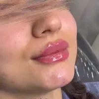 خدمات تخصصی زیبایی و مراقبت پوست و مو کلینیک راد|خدمات آرایشگری و زیبایی|تهران, صادقیه|دیوار