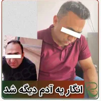 کاشت مو ابرو ریش تارکوب|خدمات آرایشگری و زیبایی|اصفهان, قلعه طبره|دیوار