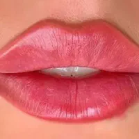 تزریق ژل و بوتاکس و فیلر بادی