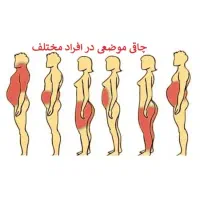 تناسب اندام چاقی لاغری