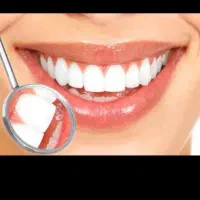 کشیدن دندان توسط دکتر نظری الان ازنا هستم