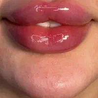 ژل و بوتاکس|خدمات آرایشگری و زیبایی|شیراز, شهرک مهدی‌آباد|دیوار