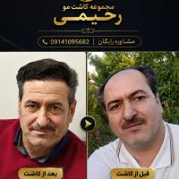 کاشت مو|خدمات آرایشگری و زیبایی|میانه, |دیوار