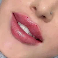 مدل ژل و بوتاکس مطب|خدمات آرایشگری و زیبایی|قشم, |دیوار