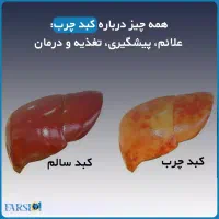 بهبود کبد چرب گرید 1 2 3