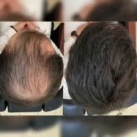 موهای پرپشت میخوای...