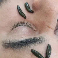 کاپینگ تراپی،حجامت تخصصی،فصد،زالو درمانی|خدمات آرایشگری و زیبایی|گرگان, |دیوار
