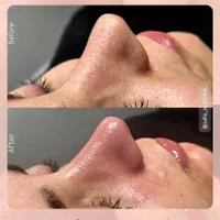 آموزش و خدمات فوق تخصصی فیشال در کلینیک پوست