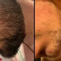 مو سر و ریش|آرایشی، بهداشتی، درمانی|تهران, فردوسی|دیوار
