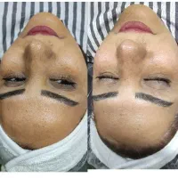 بمب تخفیفات فیشال و خدمات پوستی شروع قیمت از ۱۸۸|خدمات آرایشگری و زیبایی|شیراز, فرگاز|دیوار