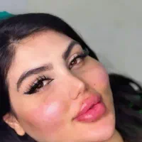 تزریق ژل بوتاکس فیلر لیزر فشیال مزو درمطب|خدمات زیبایی و سلامت|تبریز, |دیوار