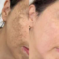 کی گفته خب نمیشی|آرایشی، بهداشتی، درمانی|کرمانشاه, |دیوار