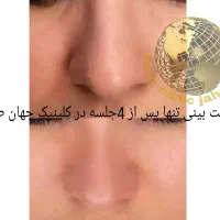 کلینیک لیزر پوست،مو جهانطلا در کرمانشاه (فوتونا)|خدمات آرایشگری و زیبایی|کرمانشاه, |دیوار