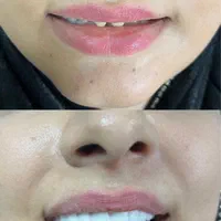 دندانپزشکی سپید|خدمات آرایشگری و زیبایی|تبریز, |دیوار