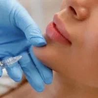 آموزش ژل بوتاکس نخ مزولیفت پی آرپی لیزرآنزیم پزشک|خدمات آموزشی|کرج, گوهردشت|دیوار