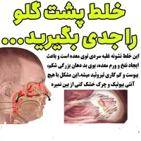خلط پشت حلق عامل اصلی سردی مغز