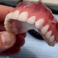 دندان مصنوعی  طراحی گرافیست بسیار طبیعی و راحت