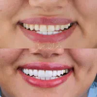 دندانپزشکی شهرقدس(بیمه تکمیلی آنلاین)  اقساطی