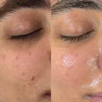 آموزشگاه تخصصی پوست|خدمات آموزشی|نجف‌آباد, شریعتی غربی|دیوار