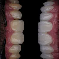 دندانپزشکی،ایمپلنت،ارتودنسی لمینت وکامپوزیت اقساطی|خدمات آرایشگری و زیبایی|نجف‌آباد, شریعتی غربی|دیوار