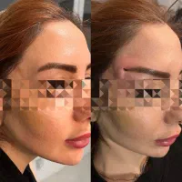 تزریق ژل و بوتاکس و مادلینگ عربی|خدمات آرایشگری و زیبایی|کرمانشاه, |دیوار