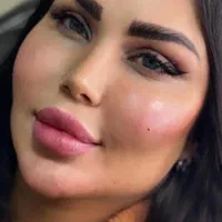 سوپرساکشن غبغب همراه بازاویه سازی تخصصی گردنُ صورت|خدمات آرایشگری و زیبایی|تهران, پاسداران|دیوار